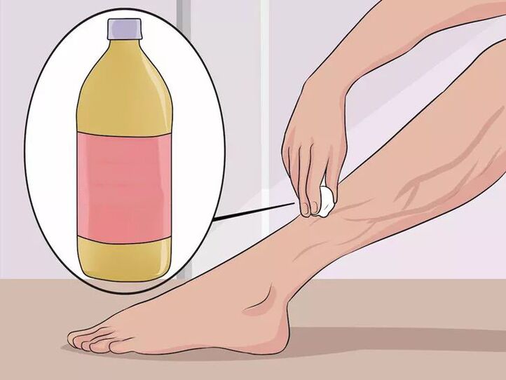 how to rub apple cider vinegar into affected areas
